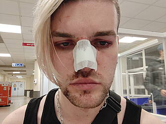 Man Assaulted In Suspected Hom...